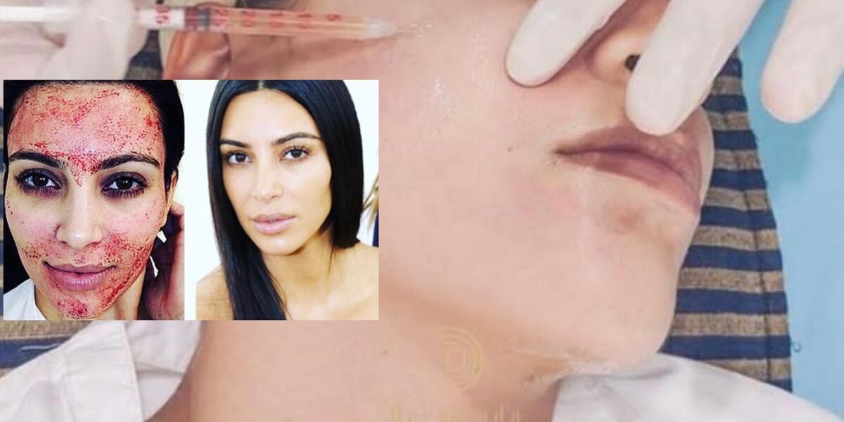Dermand Clinic تقدم تقنية الـ”PRP” بجودة عالية واهتمامٍ لا مثيل له